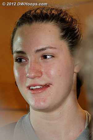 Haley Peters was a true competitor, coming back from 20+ sutures during halftime to lead Duke to a 69-63 victory, wearing a smile throughout